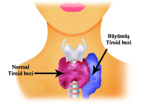 Bym Tiroid Bezi