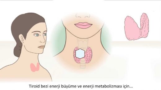 Tiroid Bezi Bymesi